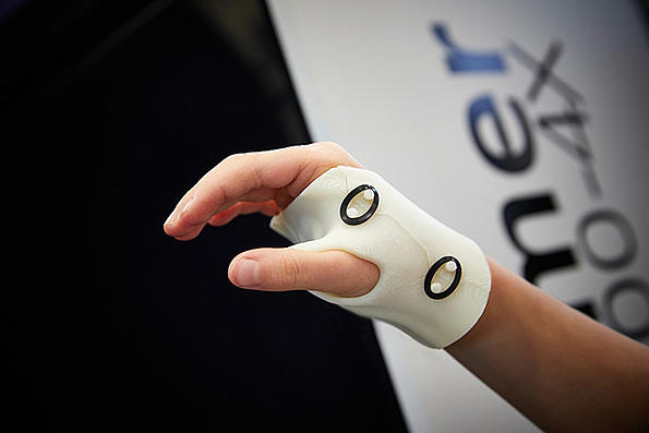 Demonstration of a hand orthosis produced with the Freeformer 300-4X (Image: ARBURG).